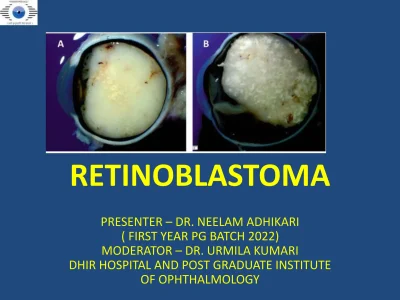 retinoblastoma-presentation-dhir-hospital-bhiwanipptx-1-2048